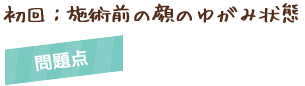初回:施術前の顔のゆがみ状態